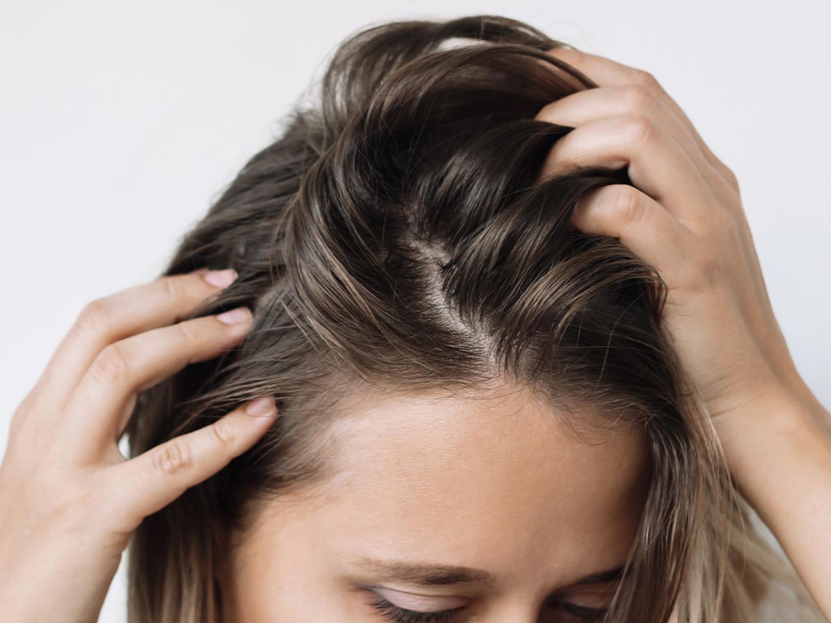 Forfora secca o grassa? Guida onesta alla cute detox